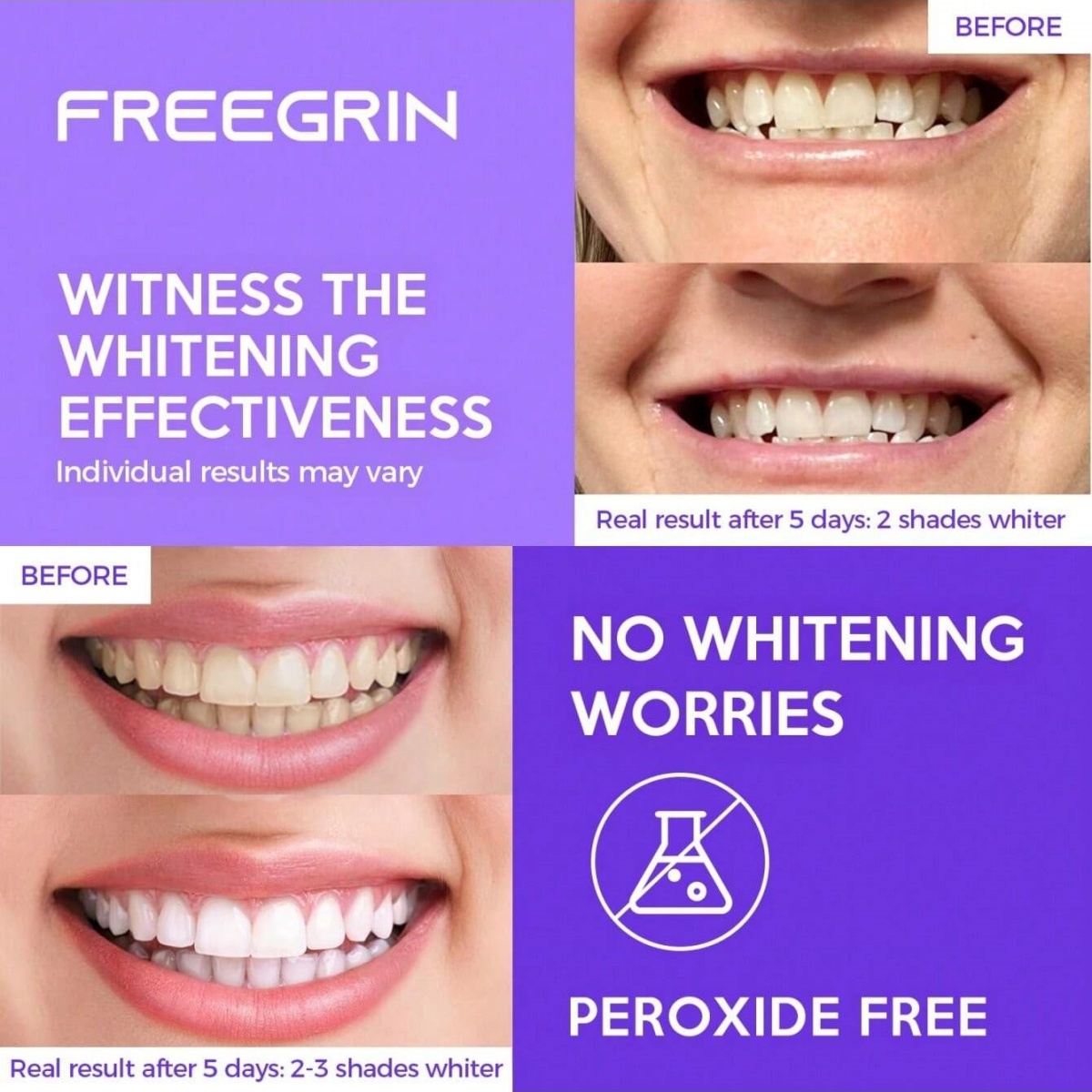 view